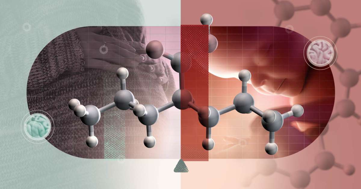 Unsafe Rise in Global Use of Antiseizure Drug Poses Risk to Unborn Children