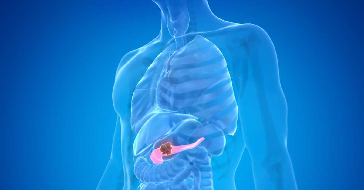 Nanomachines Pave the Way for Starvation Therapy Against Hard-to-Treat Pancreatic Cancer Nanomachines Pave the Way for Starvation Therapy Against Hard-to-Treat Pancreatic Cancer