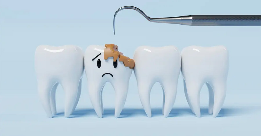 Arginine May Offer a Natural Way to Prevent Tooth Decay